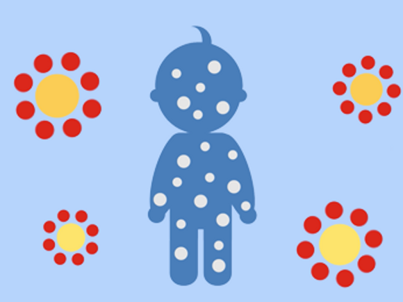 Le proteine e la prevenzione delle allergie nei neonati