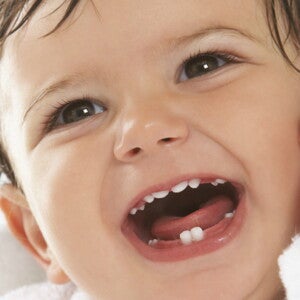 Bambino con denti da latte