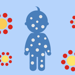 Le proteine e la prevenzione delle allergie nei neonati